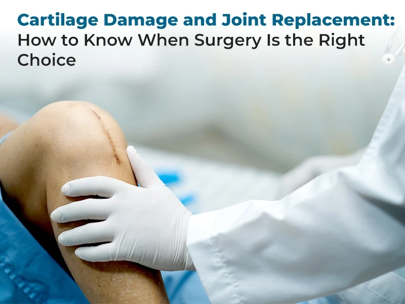 Cartilage Damage and Joint Replacement: How to Know When Surgery Is the Right Choice